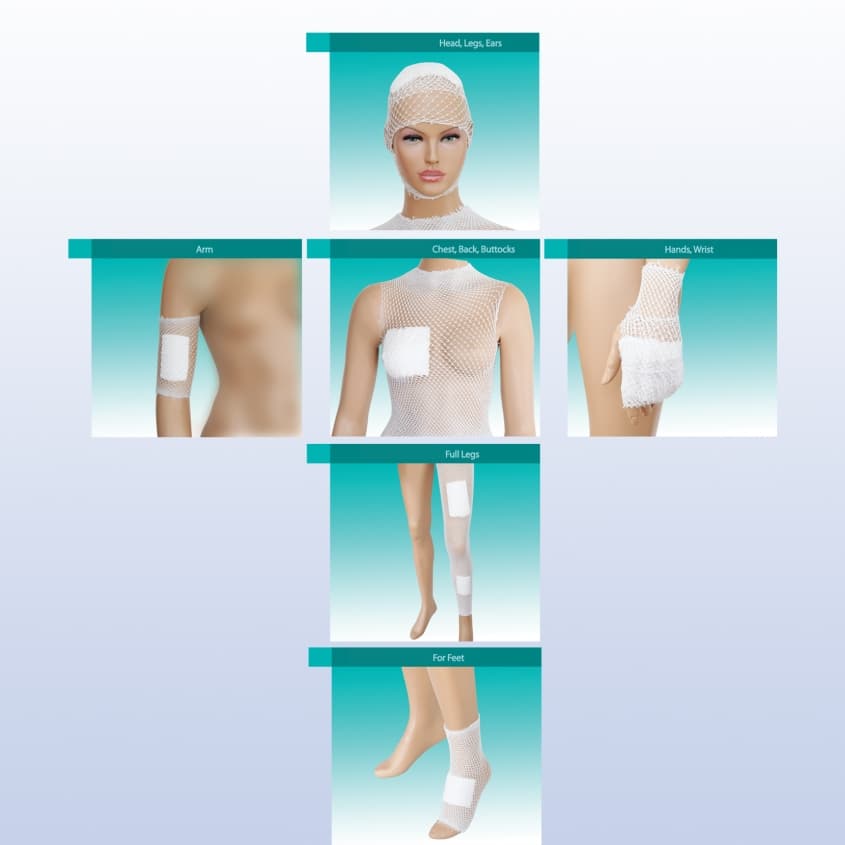 Elastic Tubular Bandages — 2