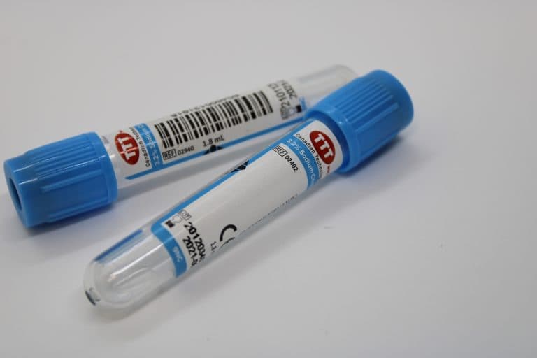 Sodium Citrate PRP Tube